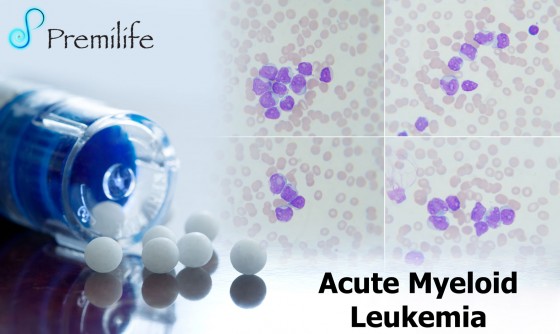 Acute-Myeloid-Leukemia