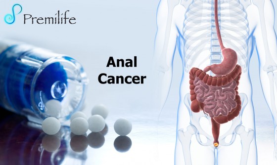 Anal-Cancer Anal-Cancer