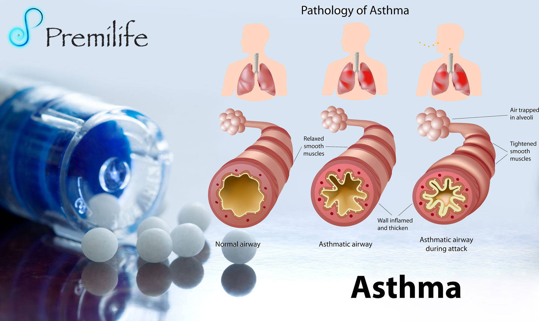 Панель астма. Астма. Бронхиальная астма. PEF астма.