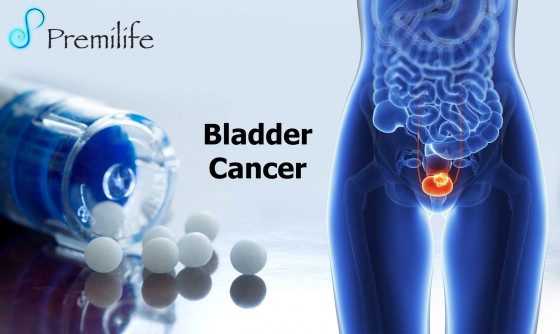Bladder-Cancer