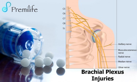 Brachial-Plexus-Injuries