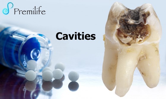 Cavities Cavities