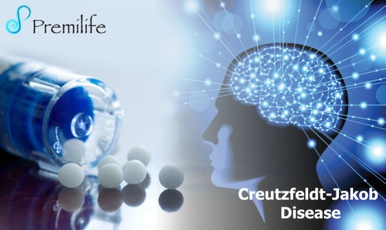 Creutzfeldt-Jakob-Disease Creutzfeldt-Jakob-Disease