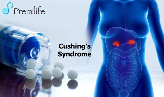 Cushing's-Syndrome Cushing's-Syndrome
