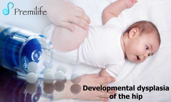Developmental-dysplasia-of-the-hip Developmental-dysplasia-of-the-hip