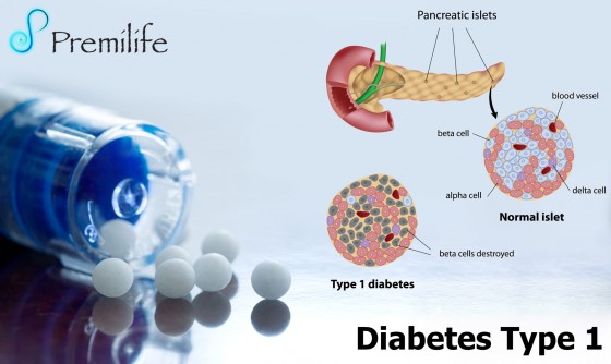 Diabetes-Type-1
