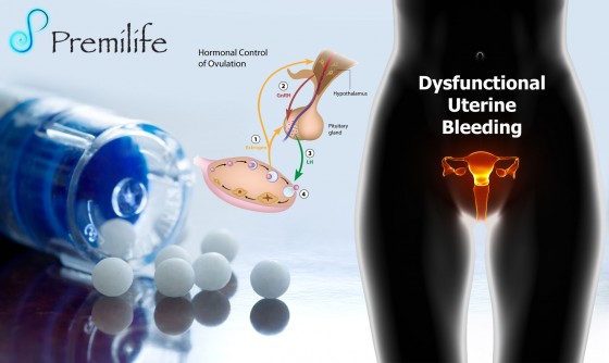 Dysfunctional-Uterine-Bleeding