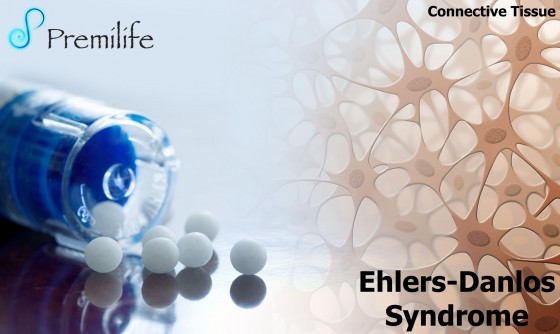 Ehlers-Danlos-Syndrome
