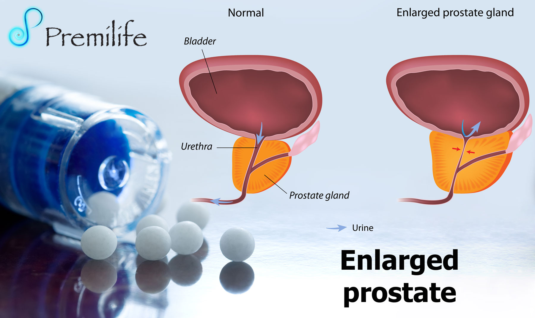 Why does the prostate become enlarged
