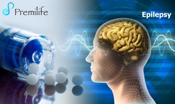 Epilepsy Epilepsy