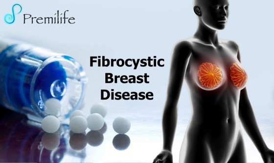 Fibrocystic-Breast-Disease