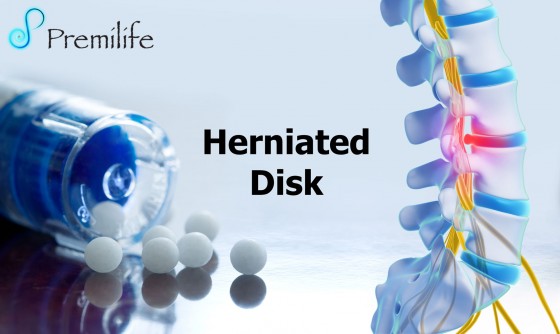 Herniated-Disk