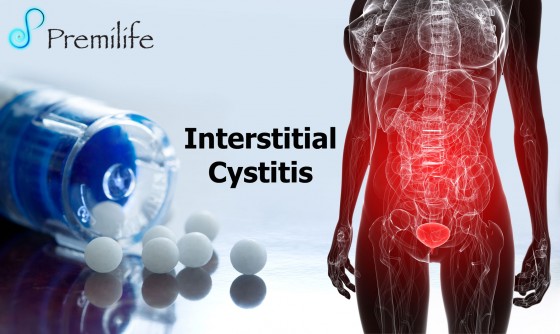 Interstitial-Cystitis