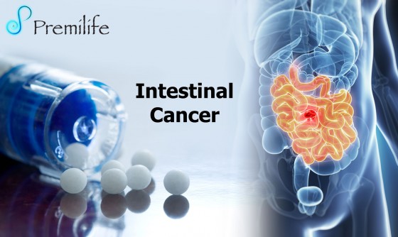 Intestinal-Cancer