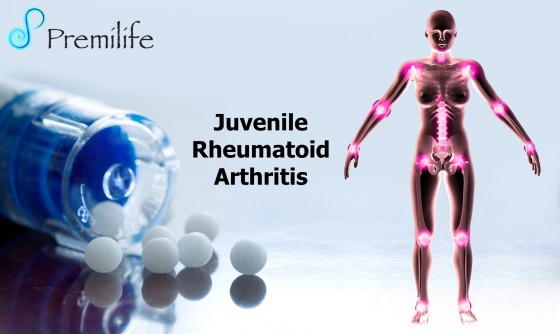 Juvenile-Rheumatoid-Arthritis
