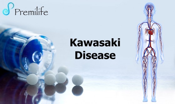 Kawasaki-Disease