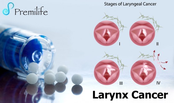 Larynx-Cancer