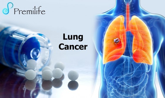 Lung-Cancer