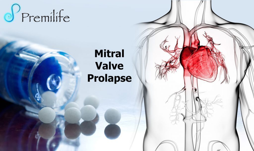 Mitral Valve Prolapse - Premilife - Homeopathic Remedies