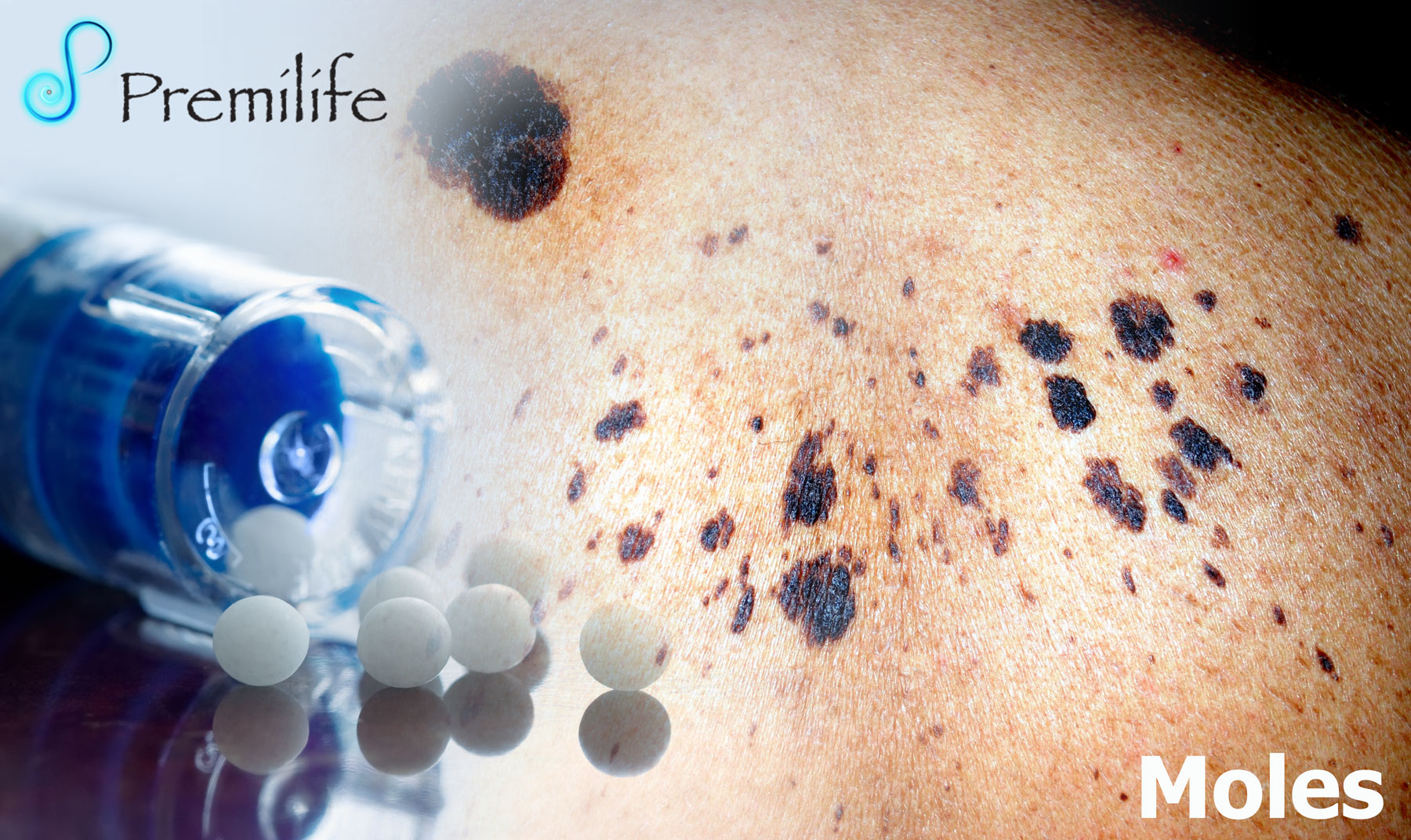 Moles | Premilife - Homeopathic Remedies
