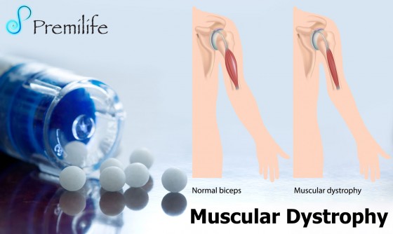 Muscular-Dystrophy