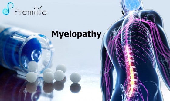 Myelopathy Myelopathy