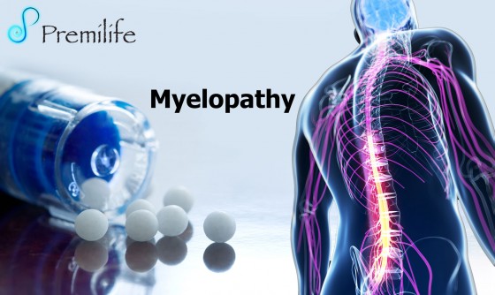 Myelopathy