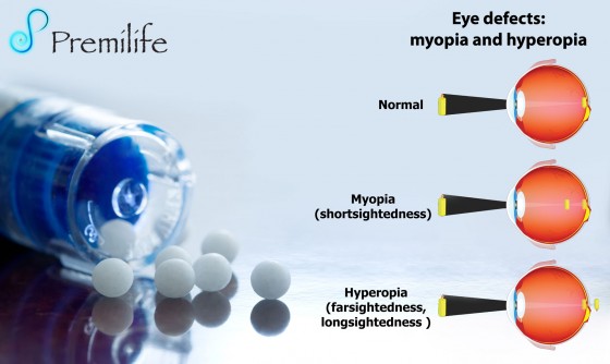 Myopia-Nearsightedness