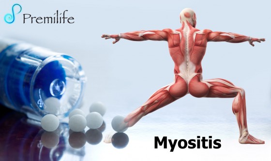 Myositis Myositis