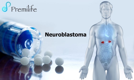 Neuroblastoma Neuroblastoma
