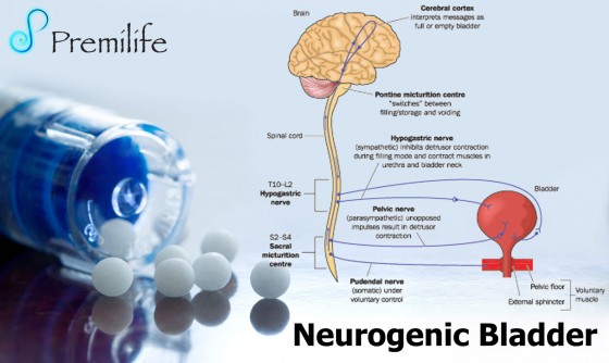 Neurogenic-Bladder