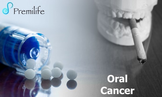 Oral-Cancer