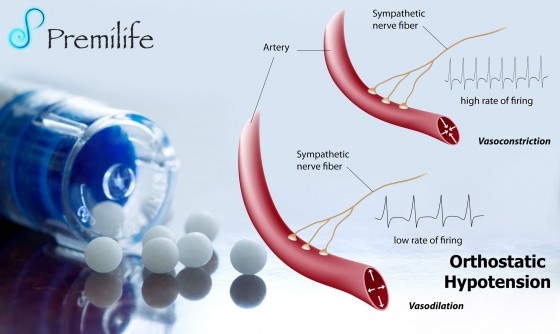 Orthostatic-Hypotension Orthostatic-Hypotension