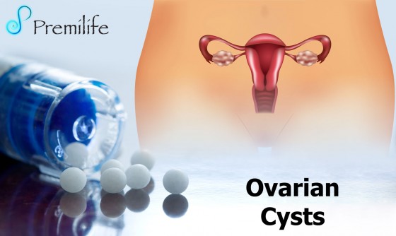 Ovarian-Cysts