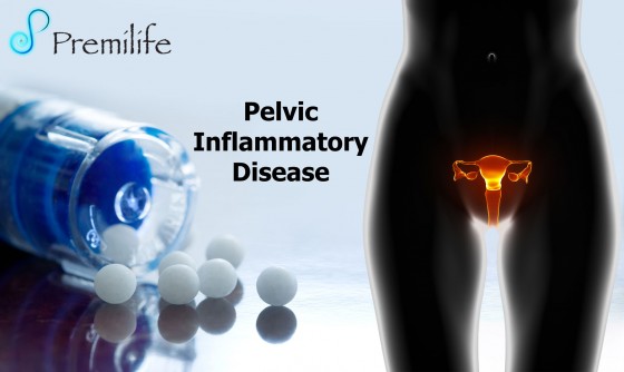 Pelvic-Inflammatory-Disease