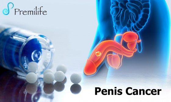 Penis-Cancer