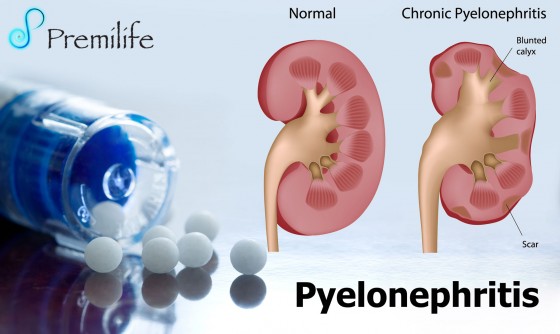 Trichomonas pyelonephritis a kerek féreg belép a testbe
