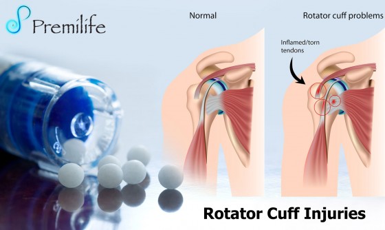 Rotator-Cuff-Injuries