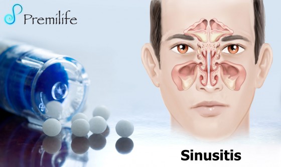 Sinusitis Sinusitis