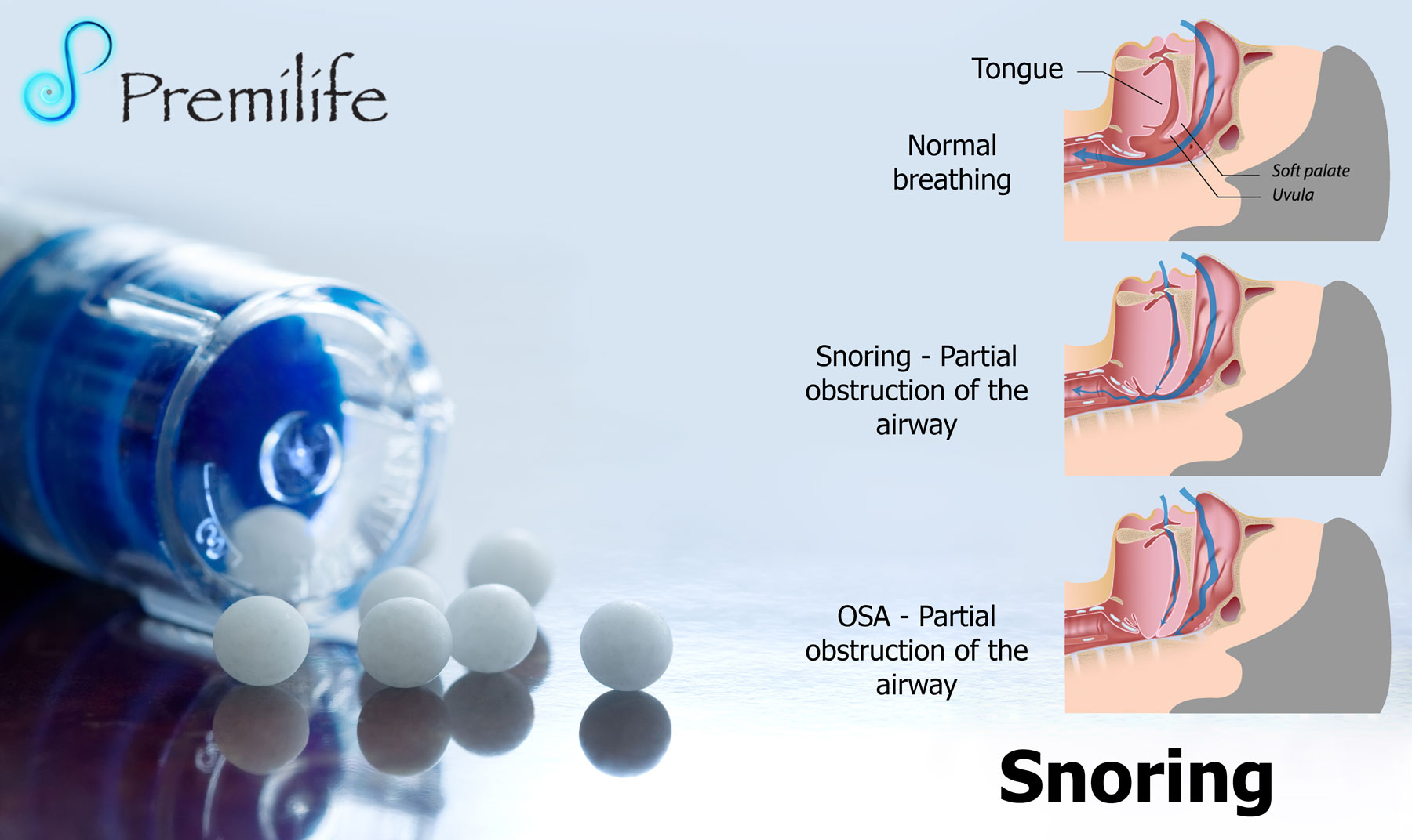 Snoring | Premilife - Homeopathic Remedies