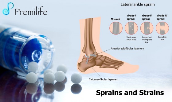 Sprains-and-Strains Sprains-and-Strains