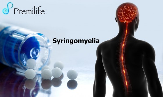 Syringomyelia-