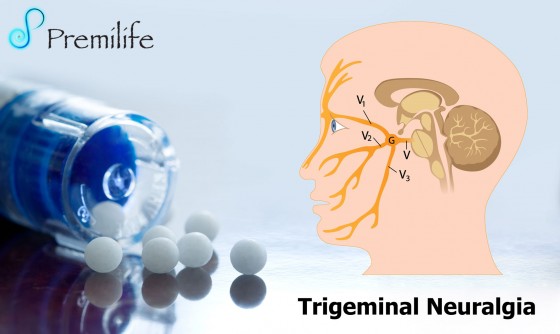 Trigeminal-Neuralgia