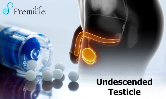 Undescended-Testicle