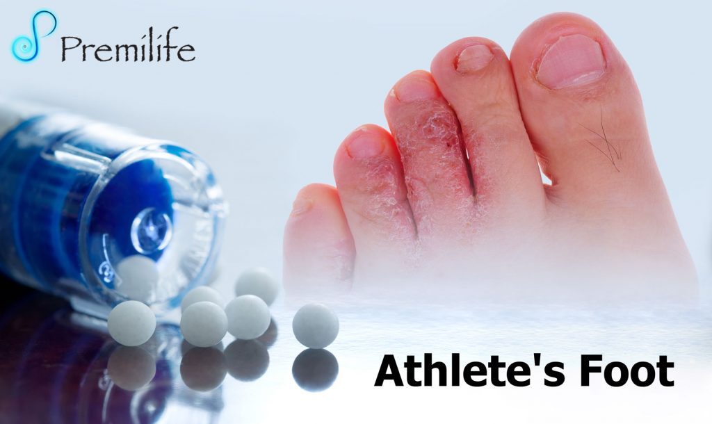 Athlete's Foot Premilife Homeopathic Remedies