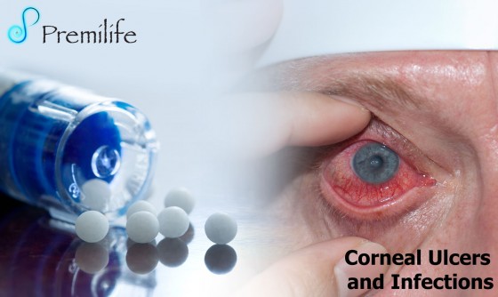 Corneal-Ulcers-and-Infections Corneal-Ulcers-and-Infections