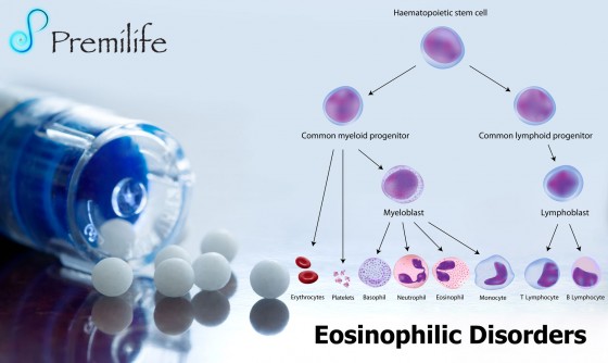 Eosinophilic-Disorders Eosinophilic-Disorders
