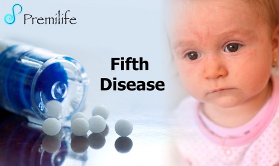 Fifth-Disease