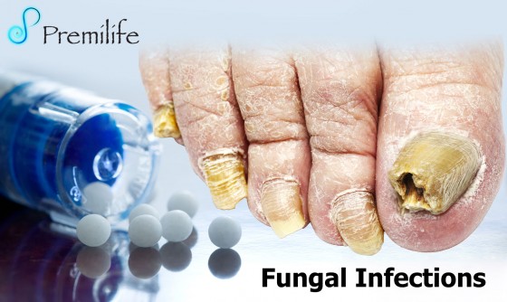 Fungal-Infections