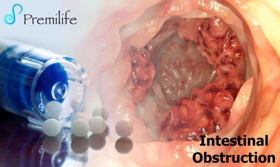 Intestinal-Obstruction Intestinal-Obstruction